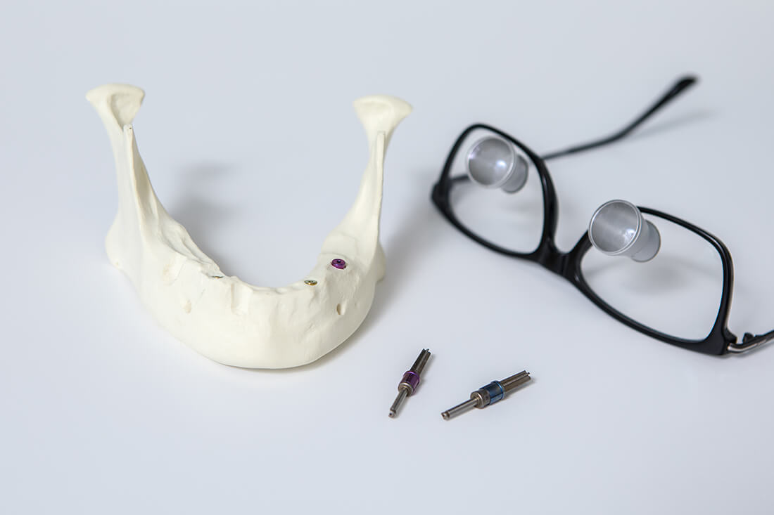 Zahnarzt Rohrbach - Dr. Zimmermann - Implantologie