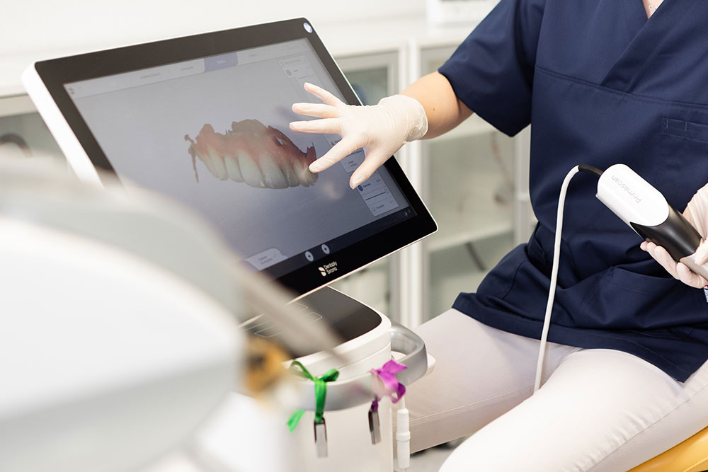 Zahnarzt-Rohrbach-Zimmermann-Leistungen-Intraoralscanner Zahnarzt-Rohrbach-Zimmermann-Leistungen-Intraoralscanner